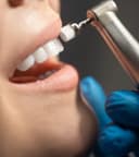 Hygienist Services
